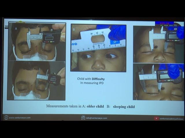AIOC2022 FP770  Pediatric   II topic Analysis of orbitofacial anthropometry in children with feature