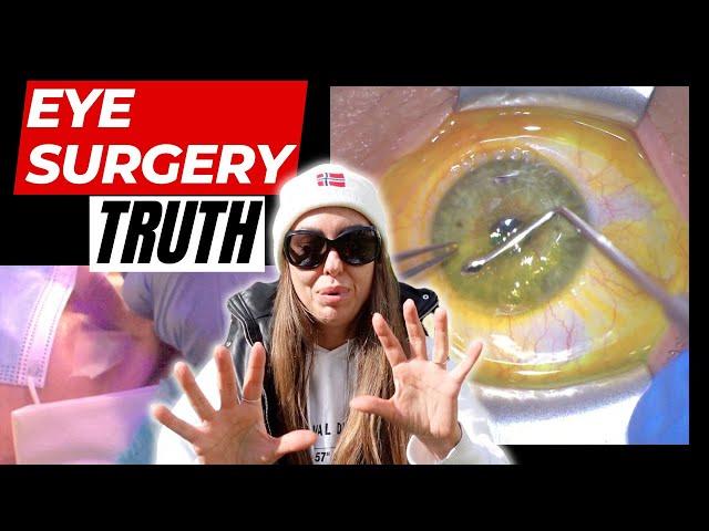 EYE SURGERY & THE BIGGEST REGRET OF MY LIFE: The Most Detailed Video about Eye Surgery with Results