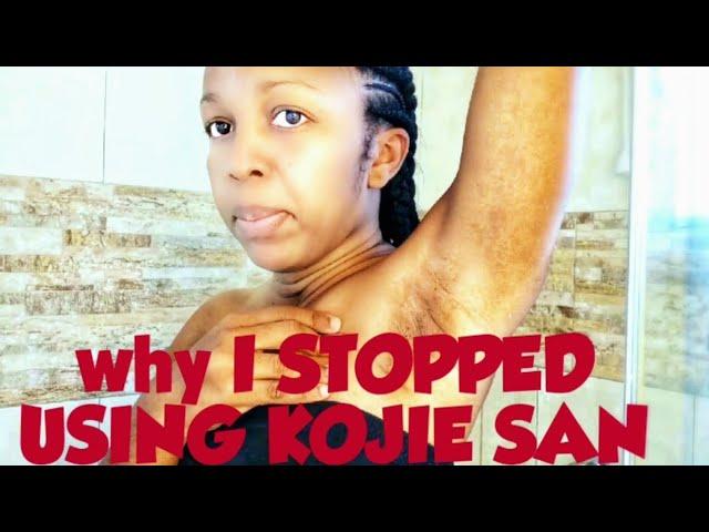 why I STOPPED USING KOJIE SAN | KOJIC ACID SOAP | SKIN LIGHTENING SOAP | CAKE SOAP | Sacha Bloom