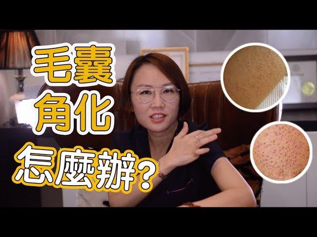 手臂、大腿上一粒粒凸起的疹子是什麼？什麼是毛囊角化症？