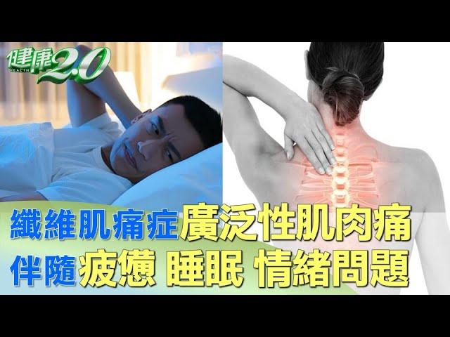 纖維肌痛症 廣泛性肌肉痛 伴隨 疲憊.睡眠.情緒問題 健康2.0@tvbshealth20