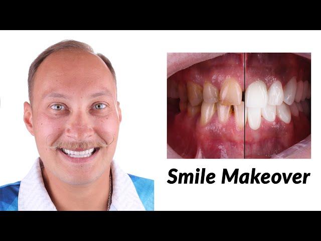 A Radiant Change: Smile Makeover Experience at Sani Dental Group