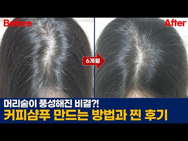 탈모걱정 사라지는 커피샴푸 6개월 실제 사용후기