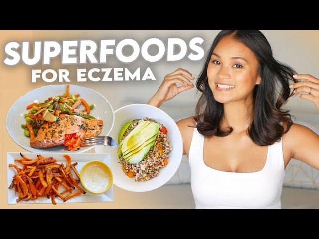 Eczema Diet: What to Eat for Clear Skin!