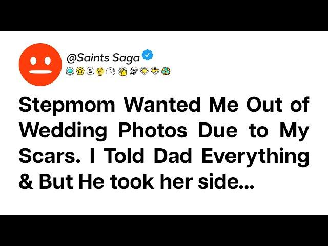 Stepmom Hates Me Because of My Scars | Reddit stories | Reddit story