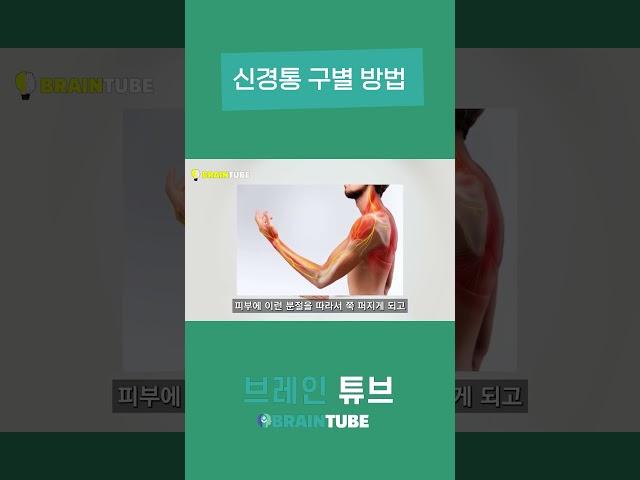 신경통 구별 방법