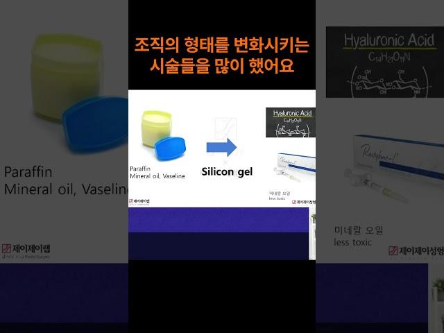 필러의 역사 - 제이제이성형외과 #shorts