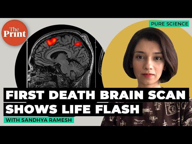 First scan of a dying human brain shows life flashes before eyes