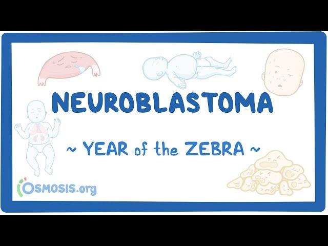 Neuroblastoma (Year of the Zebra 2024)