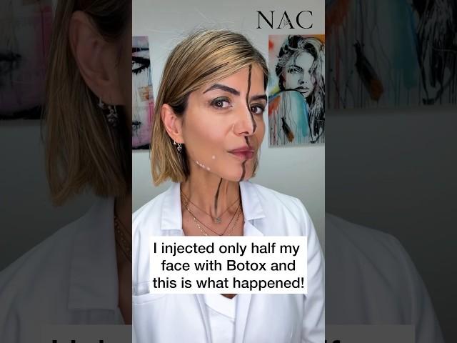 #daobotox #nefertitinecklift #neckbotox #botox #botoxtraining #nefertitinecklift #drbitafarrell