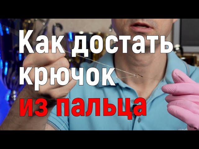 Как достать крючок из пальца