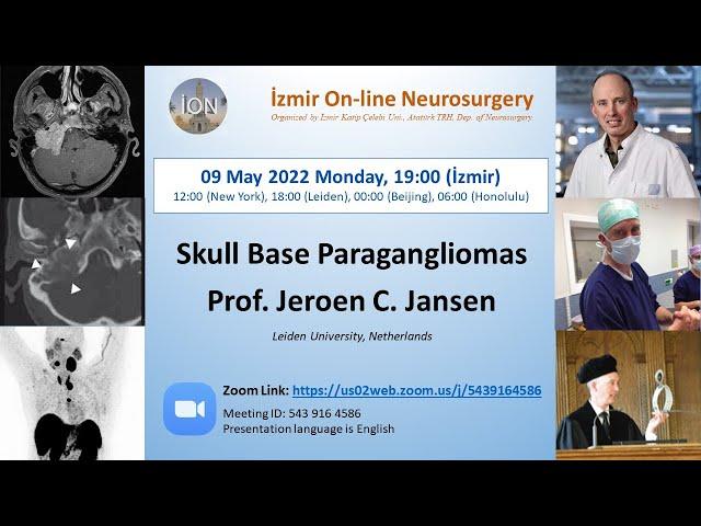 İON 236. lecture, Jansen: Skull Base Paragangliomas 09.05.22