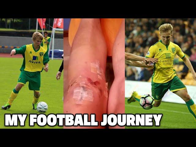 Becoming A Professional Footballer - ACL Surgery, Being Released & Academy Truth.. (My Pro Journey)