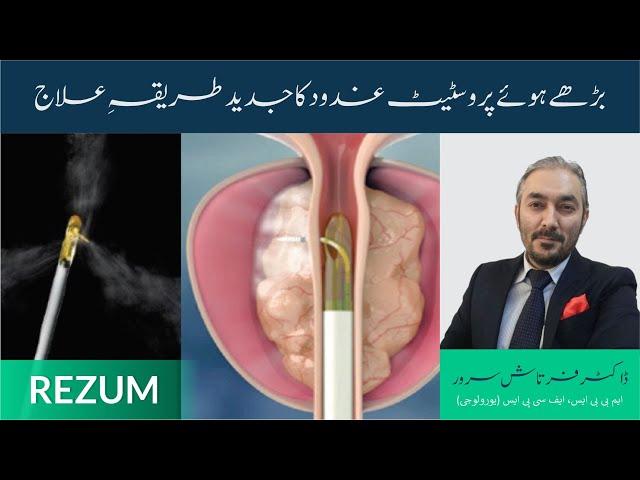 REZUM | بڑھے ہوئے پروسٹیٹ کا جدید طریقہ علاج |  Treatment And Benefits |By Dr. Fartash Sarwar