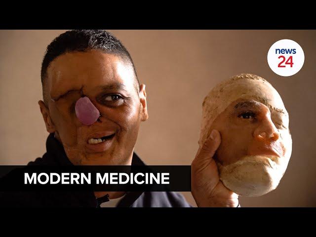 WATCH | Modern Medicine: Cancer survivor's new face brings renewed hope