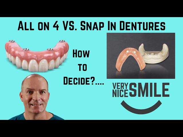 All on 4 or Snap in dentures? Some points to consider.