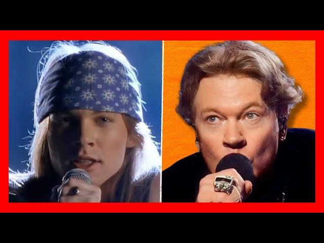 Guns N’Roses Axl Rose VOICE  Then and Now