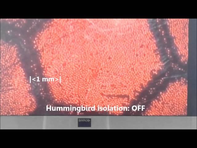 Vibration isolation of surgical microscopes