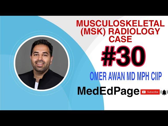 Musculoskeletal (MSK) Radiology CASE #30