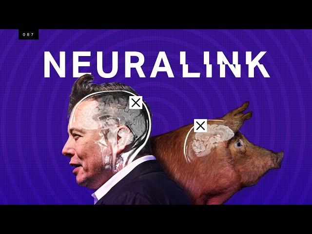 Elon Musk’s Neuralink: what’s science and what’s not