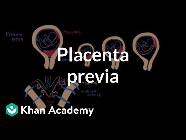 Placenta previa | Reproductive system physiology | NCLEX-RN | Khan Academy