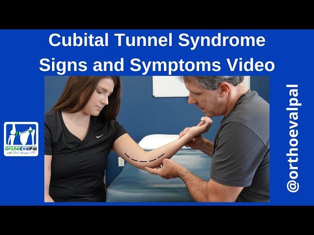 Cubital Tunnel Syndrome: Signs and Symptoms