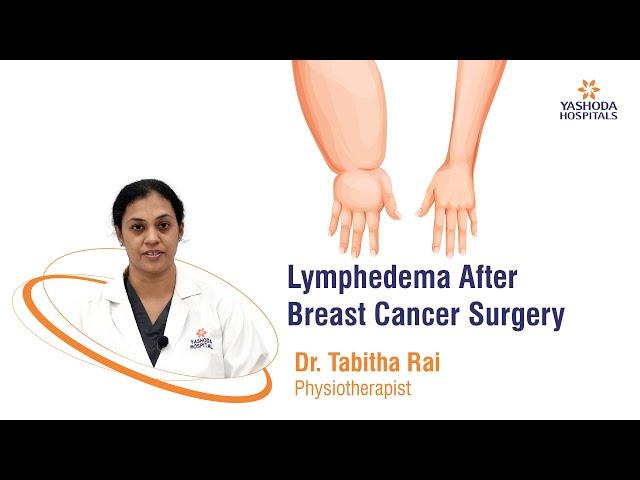 Lymphedema After Breast Cancer Surgery | Yashoda Hospitals Hyderabad