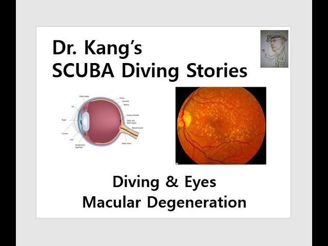 Dr. Kang's SCUBA Diving Stories - Macula Degeneration and Diving