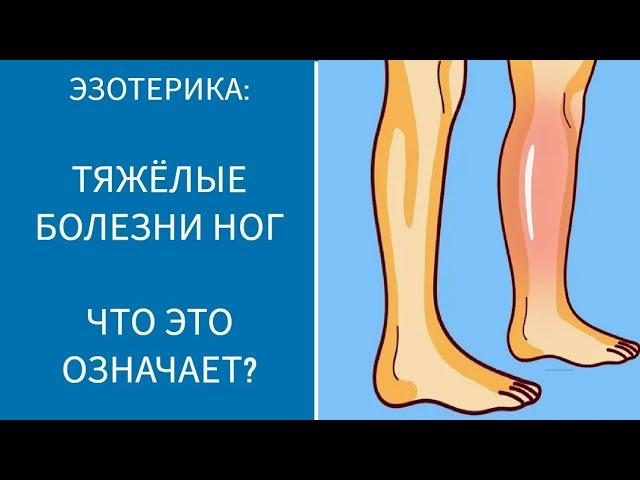 ТЯЖЁЛЫЕ БОЛЕЗНИ НОГ. ЧТО ЭТО ОЗНАЧАЕТ?