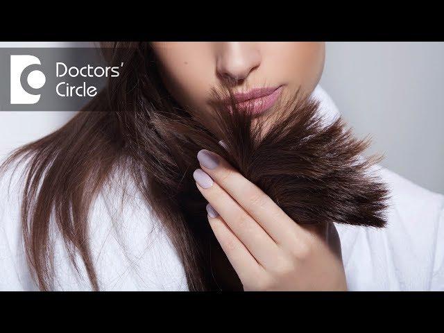 How to manage hair loss in late 20's? - Dr. Rashmi Ravindra