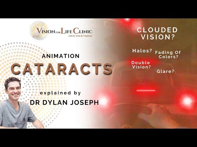 How Do Cataracts Affect Your Vision? | Animation explained by Dr Dylan Joseph