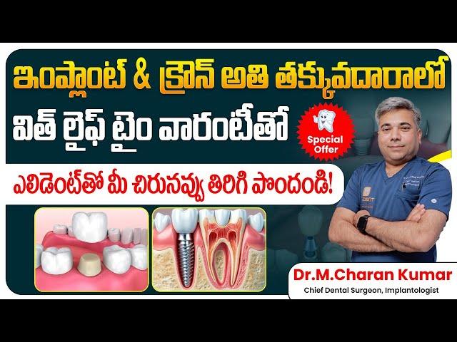 Eledent Offers Titanium Implants & Zinc-Crony Crown at an Unbeatable Price | EledentDental Hospitals