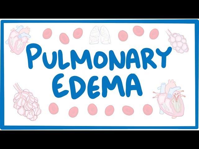 Pulmonary Edema - causes, symptoms, diagnosis, treatment, pathology