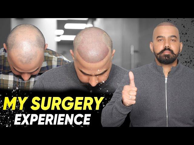 Hair Transplant in Sirsa | Best Results & Cost of Hair Transplant in Sirsa