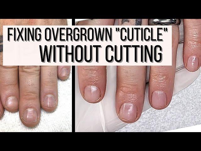 How to FIX Overgrown Cuticles WITHOUT CUTTING.