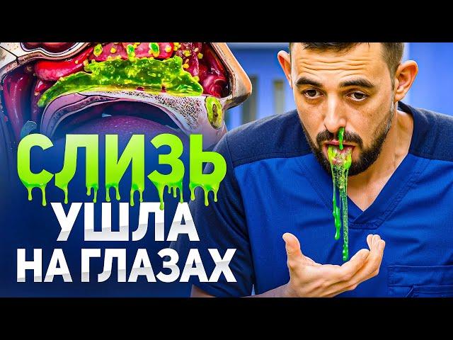 Избавься от слизи в горле и насморка и заложенности за 3 минуты БЕЗ лекарств!