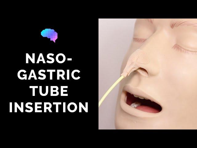 Nasogastric (NG) Tube Insertion - OSCE Guide | UKMLA | CPSA | PLAB 2