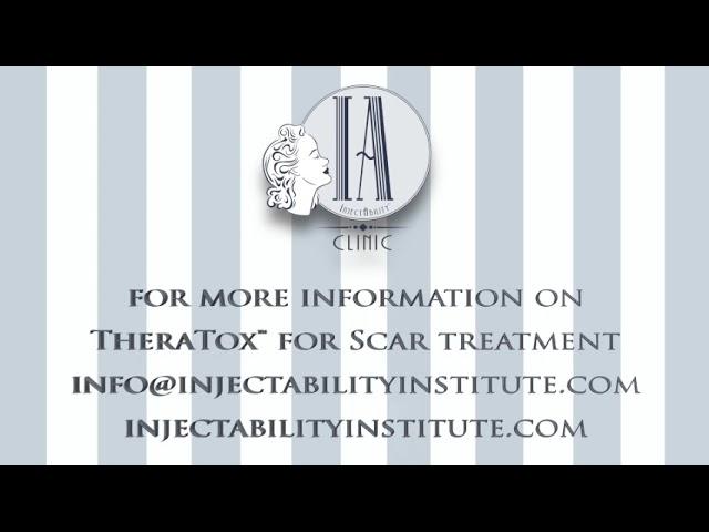 Scar treatment using #botoxinjections with InjectAbility #theratox