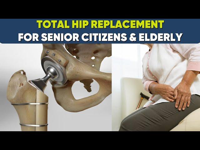 Total Hip Replacement for the elderly: Is it successful ?  #totalhipreplacementsurgery