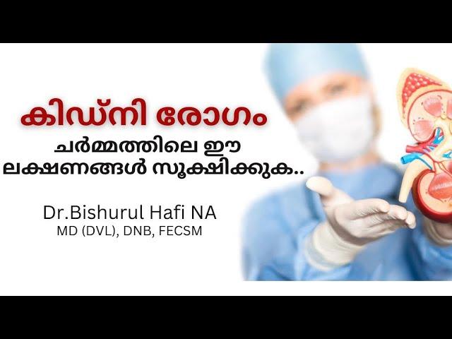 Kidney diseases and skin health: Dr Bishurul Hafi MD