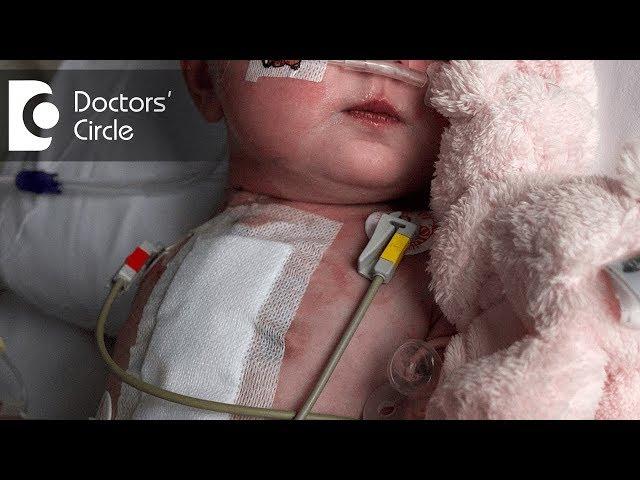 Does Atrial Septal Defect in newborn heal by itself? - Dr. Durgaprasad Reddy B