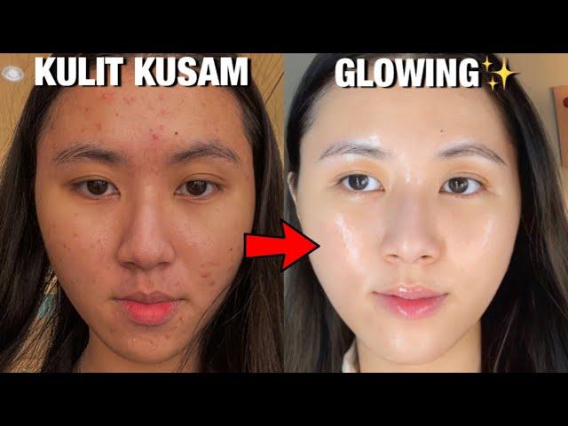 5 CARA AMPUH Untuk KULIT CERAH & GLOWING || Dari Kusam jadi Glowing! 