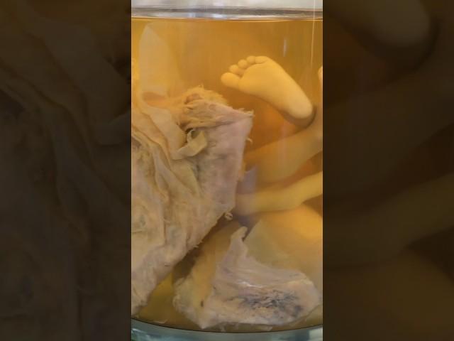 Amazing Human Fetus