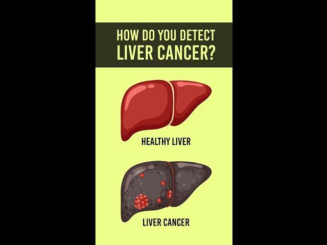 How to Detect Liver Cancer | How to Know Liver Cancer | Liver Cancer Symptoms