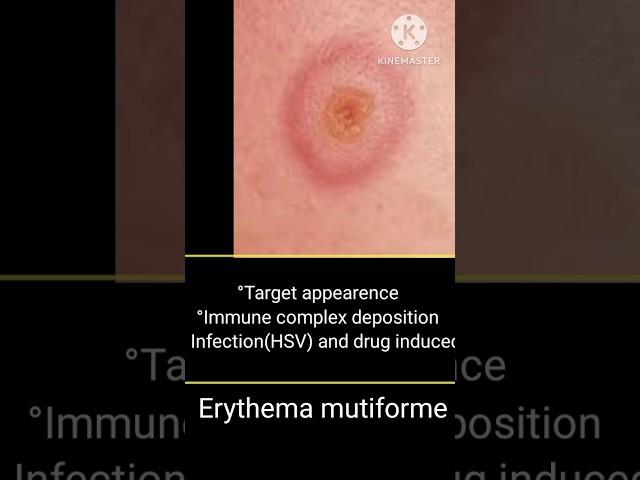 Erythema types