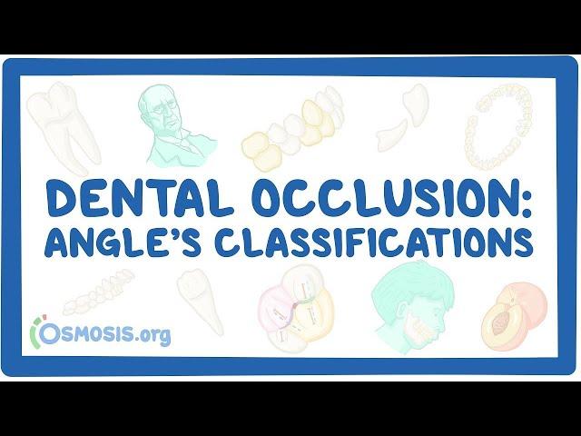 Dental occlusion - Angle’s classifications