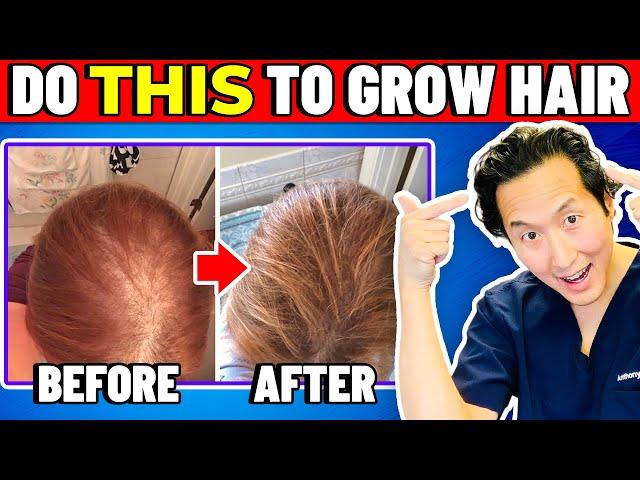 How to Treat Thinning Hair The Holistic Way!