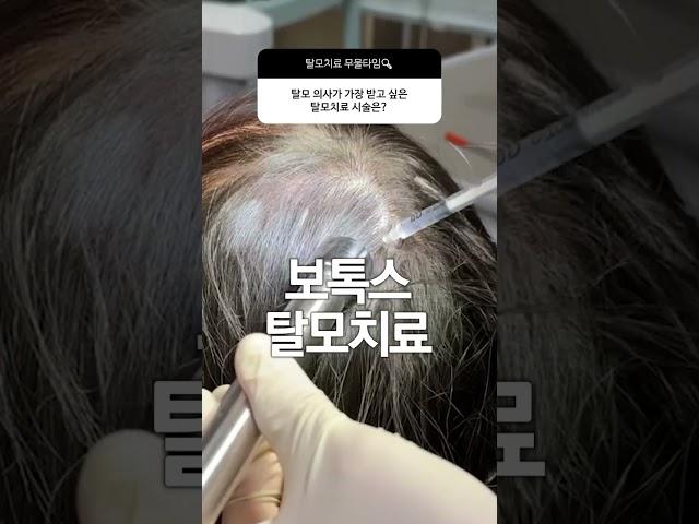 탈모의사가 가장 받고 싶은 탈모치료 시술