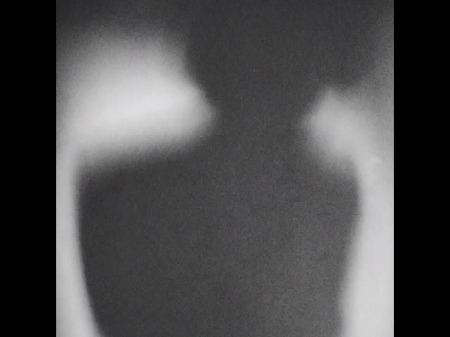 [INSOMNIA]:(5) INTERLUDE