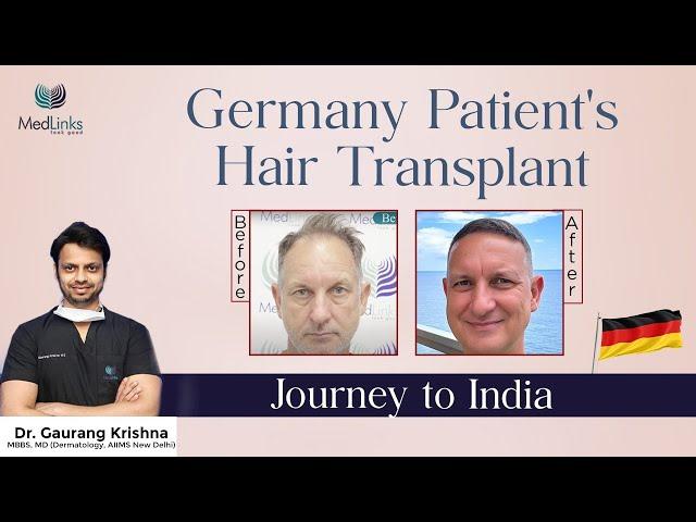 From Germany to India: Life-Changing Hair Transplant Journey at MedLinks | Hair Transplant in Delhi